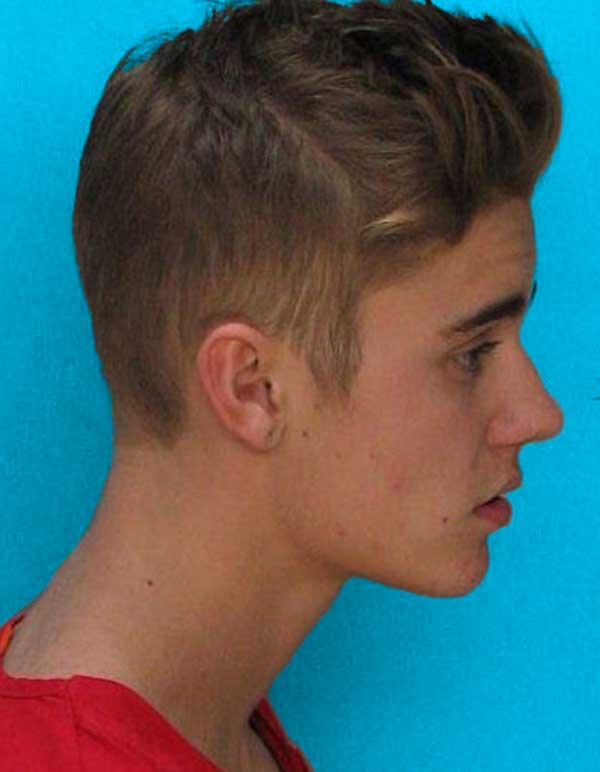 Forward Head