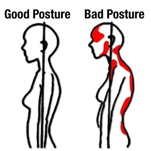 Posture