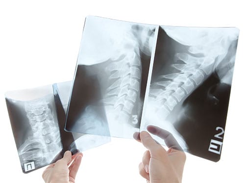 Radiologist Neck Hammock