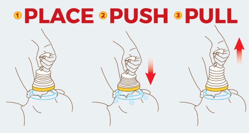 place push pull