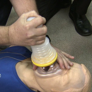 Lifevac placed on mouth