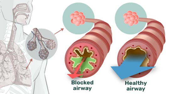 airphysio-ad-strengthen-lungs-3