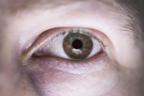 How to Lift Hooded Eyelids?