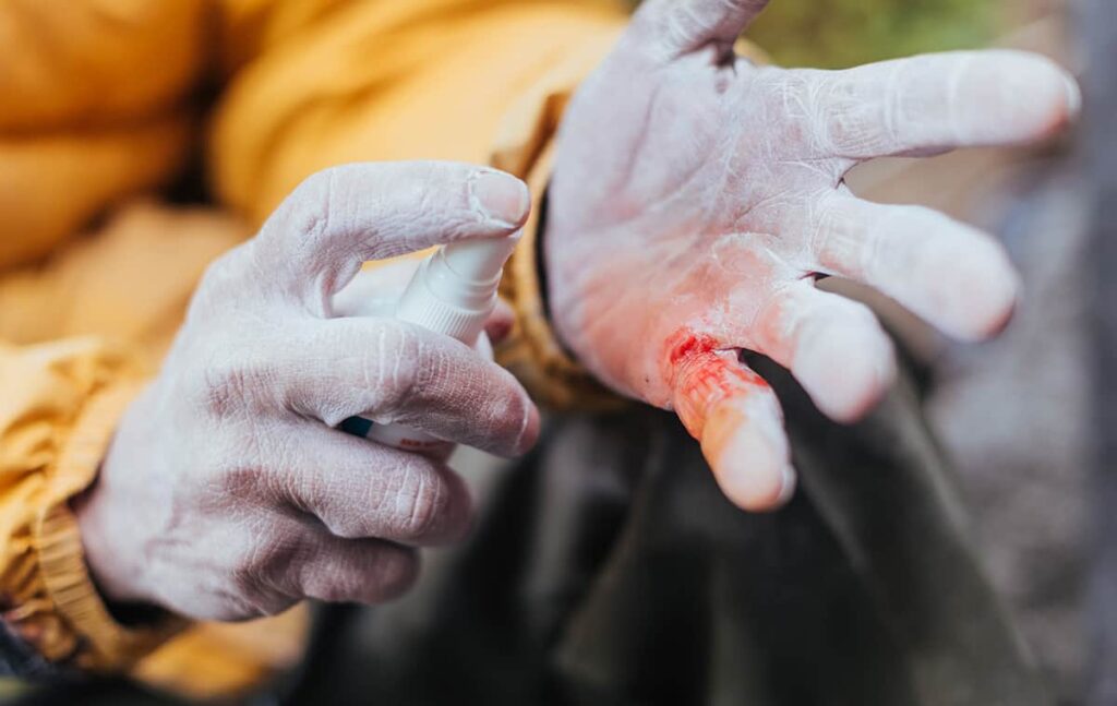 What Is an Antiseptic Spray?