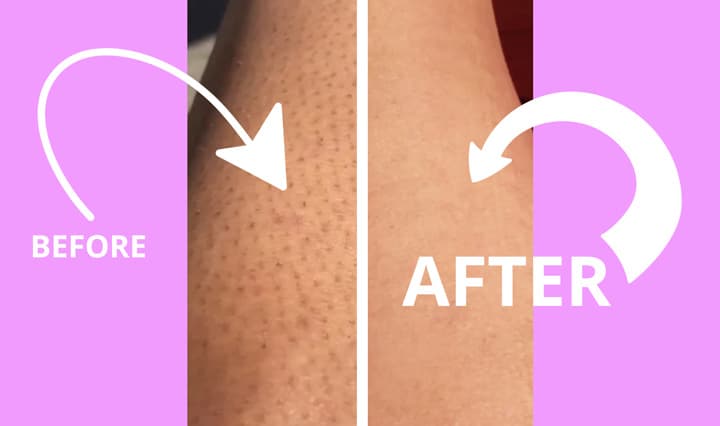 Bleame before and after