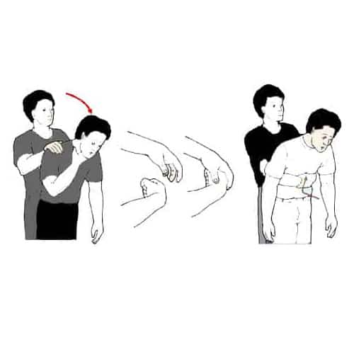 Heimlich Maneuver