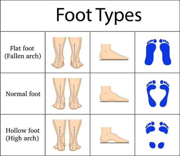Foot Types