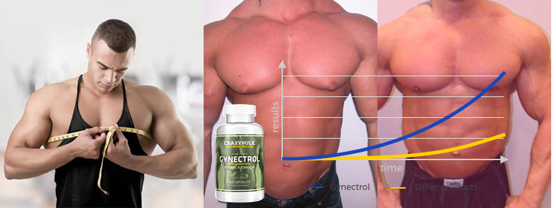 Gynectrol Gynecomastia
