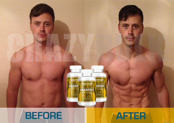 Anadrole before after