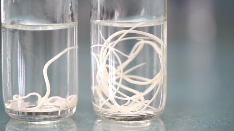 Worm Infestation in the Intestines