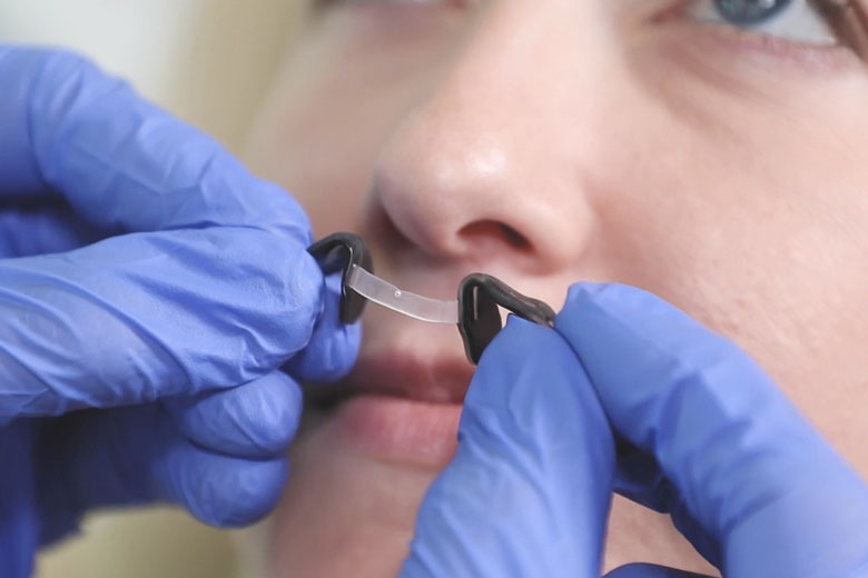 Do Doctors Recommend Nasal Dilators?
