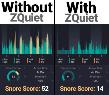 ZQuiet snore score