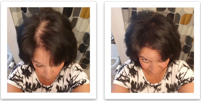 Caboki before and after
