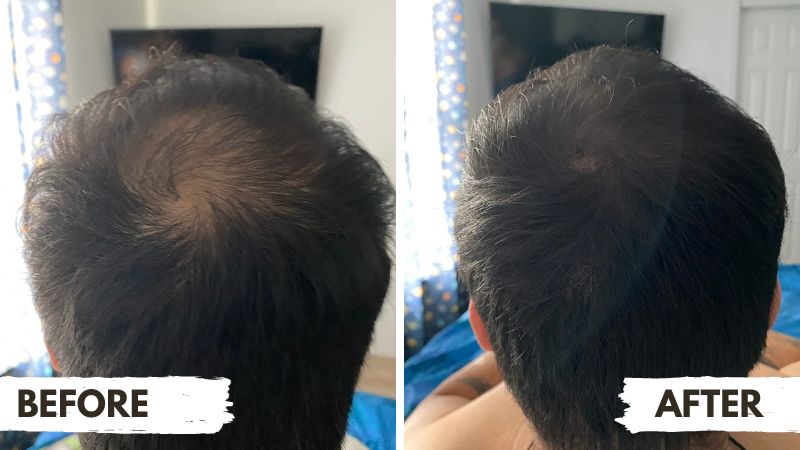 boldify man before and after