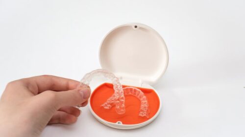 6 Best Retainer Cases for 2026 - Buyer's Guide