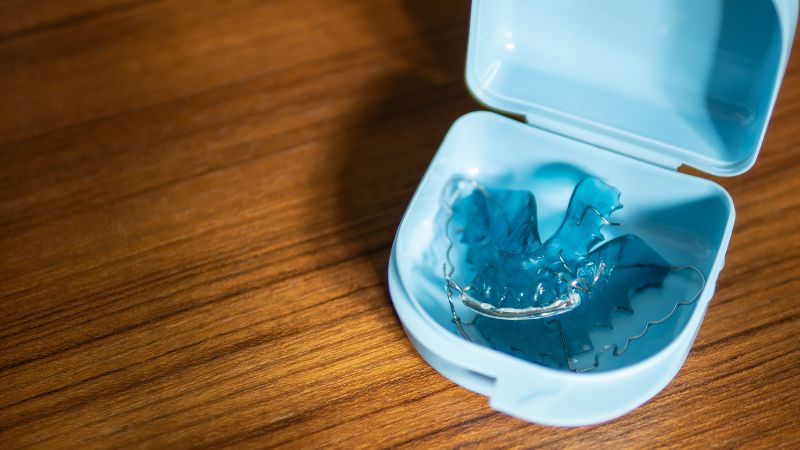 choosing retainer case