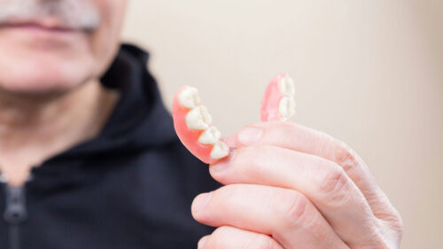 How to Clean Dentures