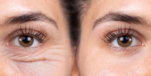 10 Best Peptide Eye Creams That Actually Work in 2025